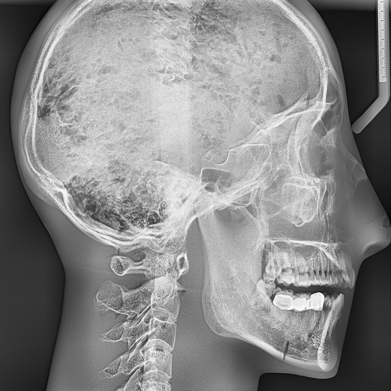 QUART Dental X-Ray Head Phantom 