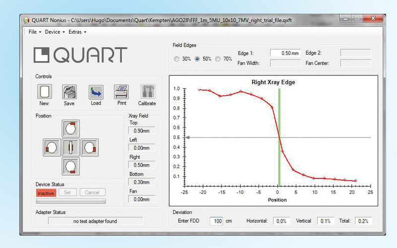 QUART nonius