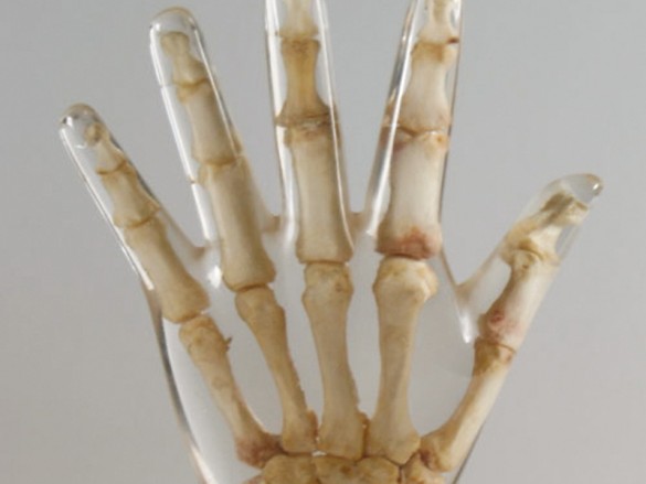 Quart X-Ray Hand Phantom