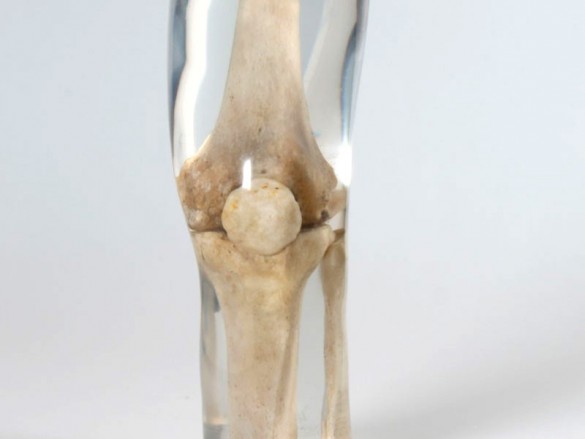 Quart X-Ray Knee Phantom