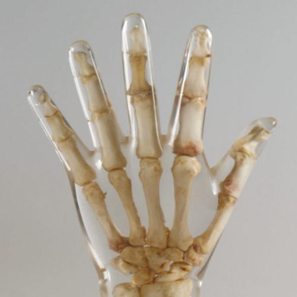 Quart X-Ray Hand Phantom