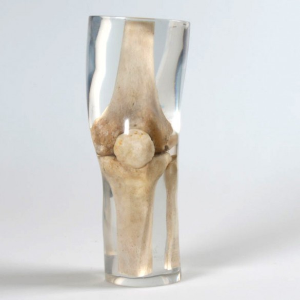 Quart X-Ray Knee Phantom